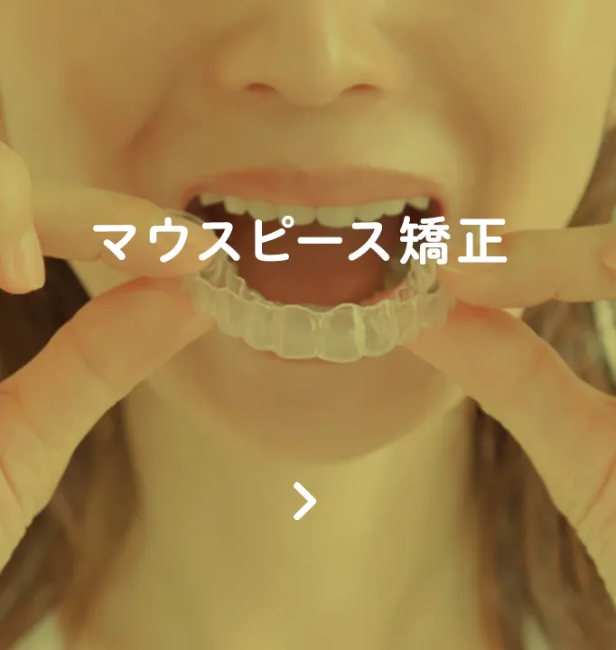 マウスピース矯正